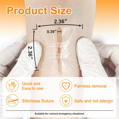 "CARBOU 2PCS Zipper Painless Wound Closure Device - Suture-Free Emergency Laceration Kit"