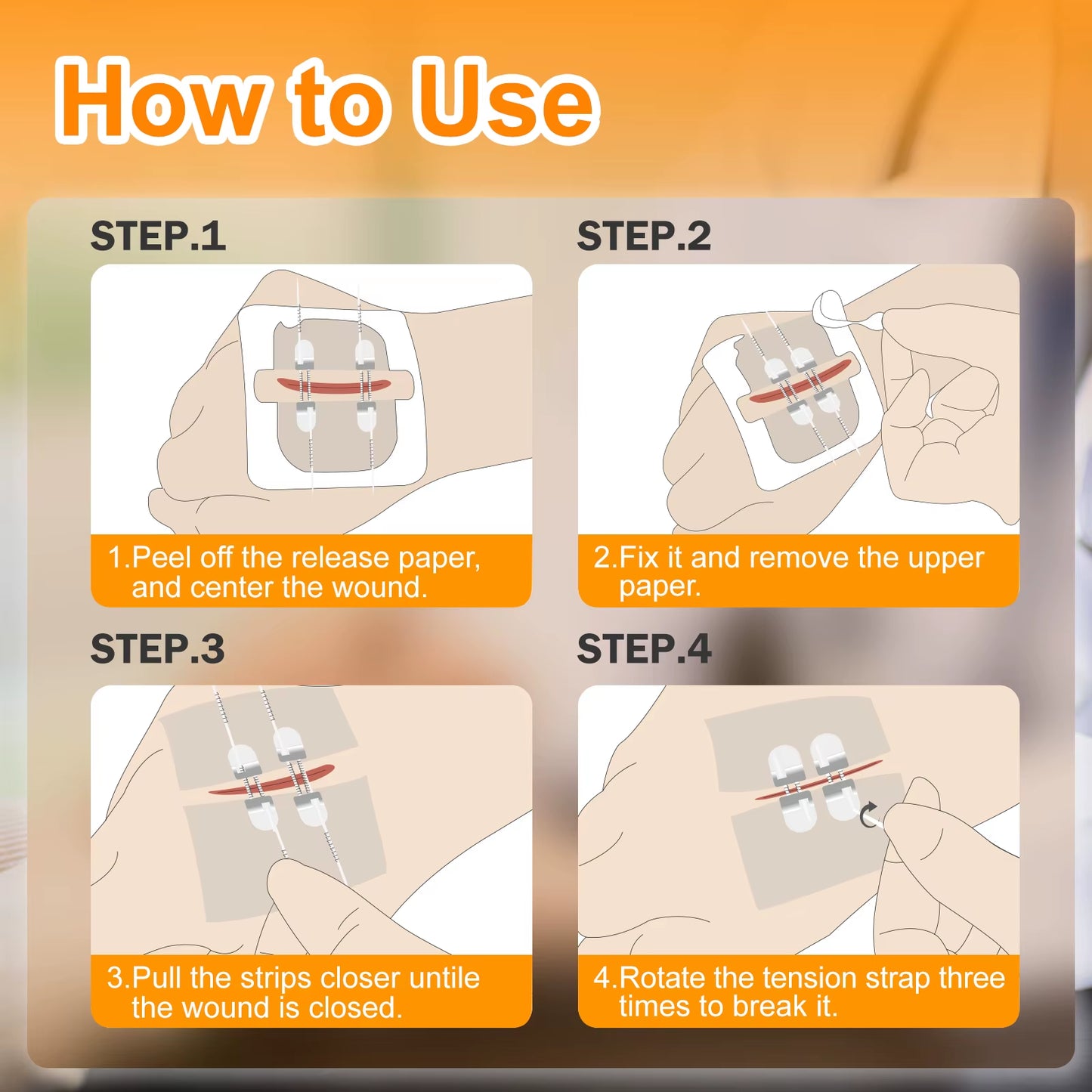 "CARBOU 2PCS Zipper Painless Wound Closure Device - Suture-Free Emergency Laceration Kit"