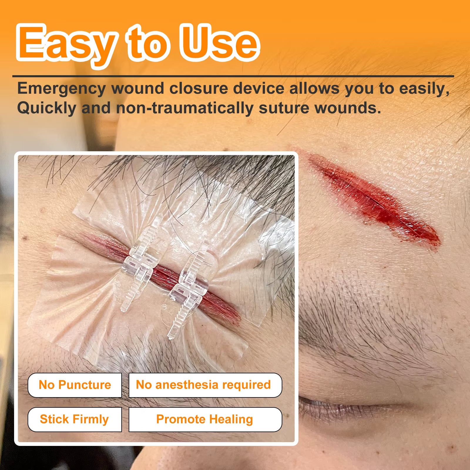 "CARBOU 2PCS Zipper Painless Wound Closure Device - Suture-Free Emergency Laceration Kit"