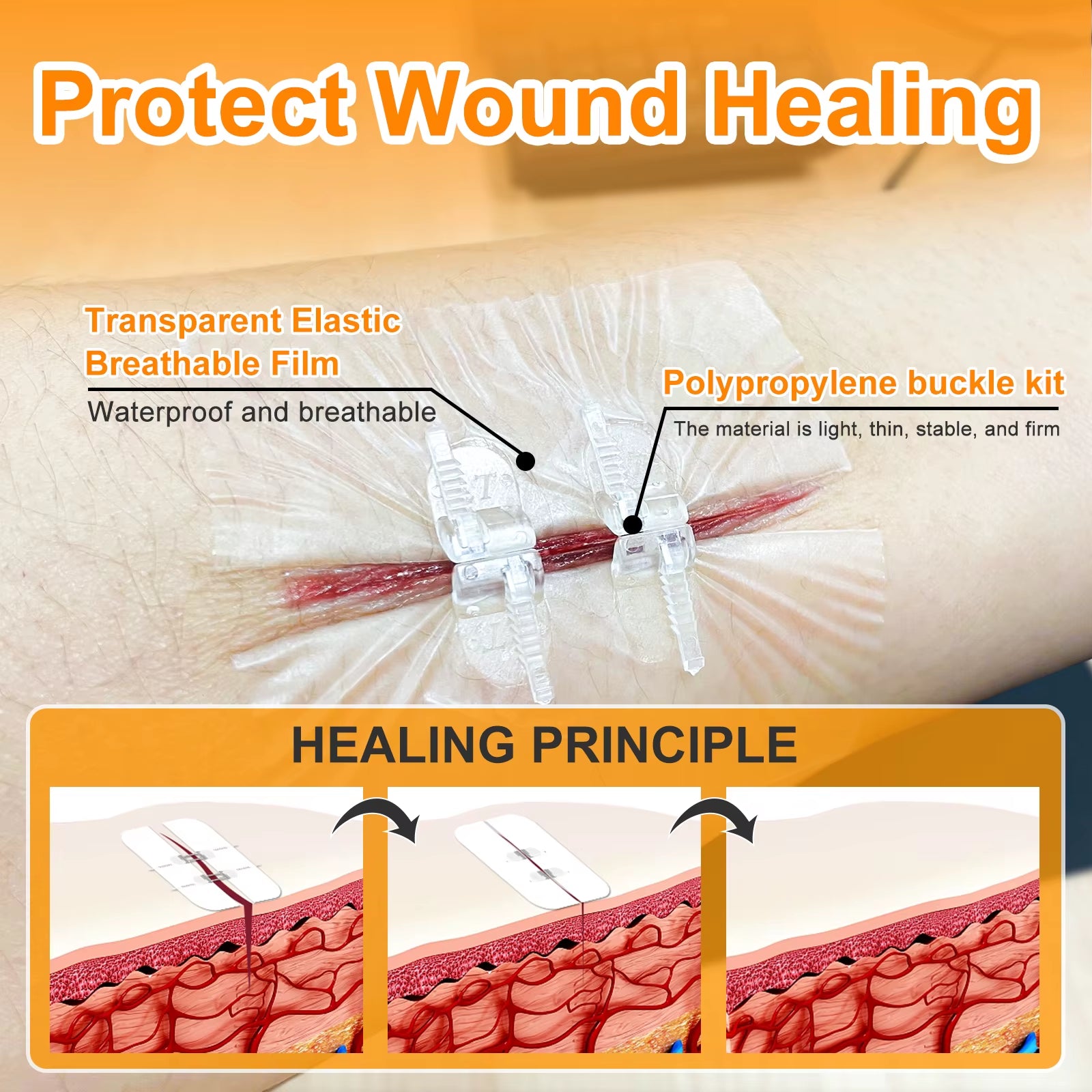 "CARBOU 2PCS Zipper Painless Wound Closure Device - Suture-Free Emergency Laceration Kit"