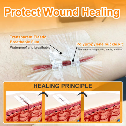 "CARBOU 2PCS Zipper Painless Wound Closure Device - Suture-Free Emergency Laceration Kit"